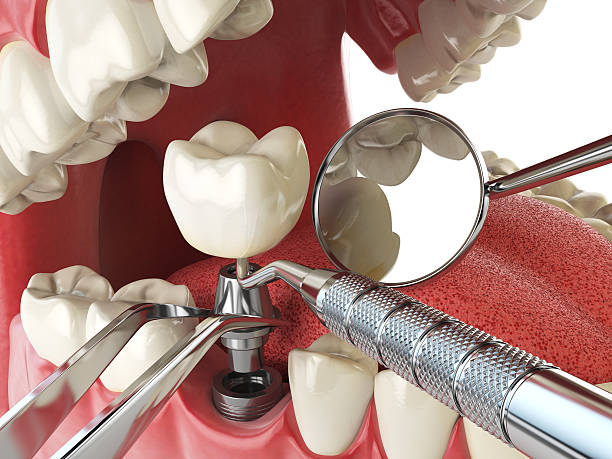 Best Emergency Dental Care for Broken or Chipped Teeth in Anthony, NM