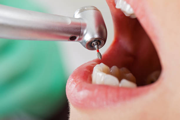 Best Emergency Dental Care for Broken or Chipped Teeth in Anthony, NM